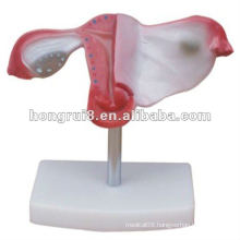 ISO 2012 Natural Size Uterus Model HR-436, artificial abortion simulated uterus model